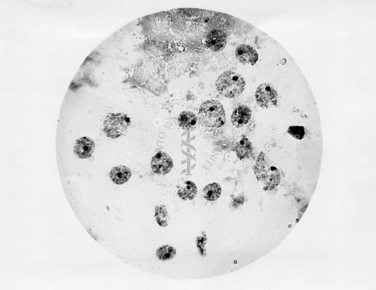 Nuclei di corpo luteo colorati al carminio acetico secondo Barzilai - microfotografia originale 450 ingr.