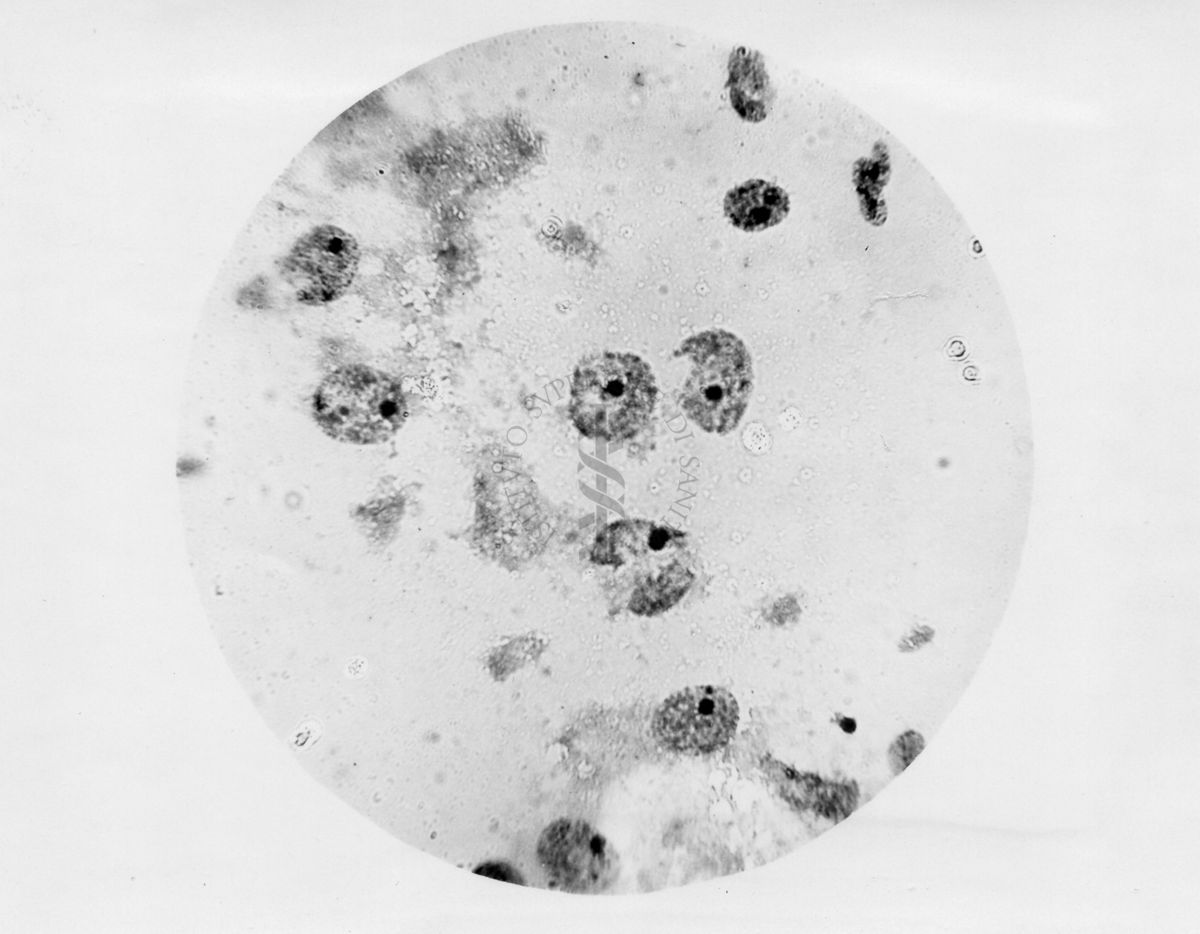 Nuclei di corpo luteo colorati al carminio acetico secondo Barzilai - microfotografia originale 450 ingr.