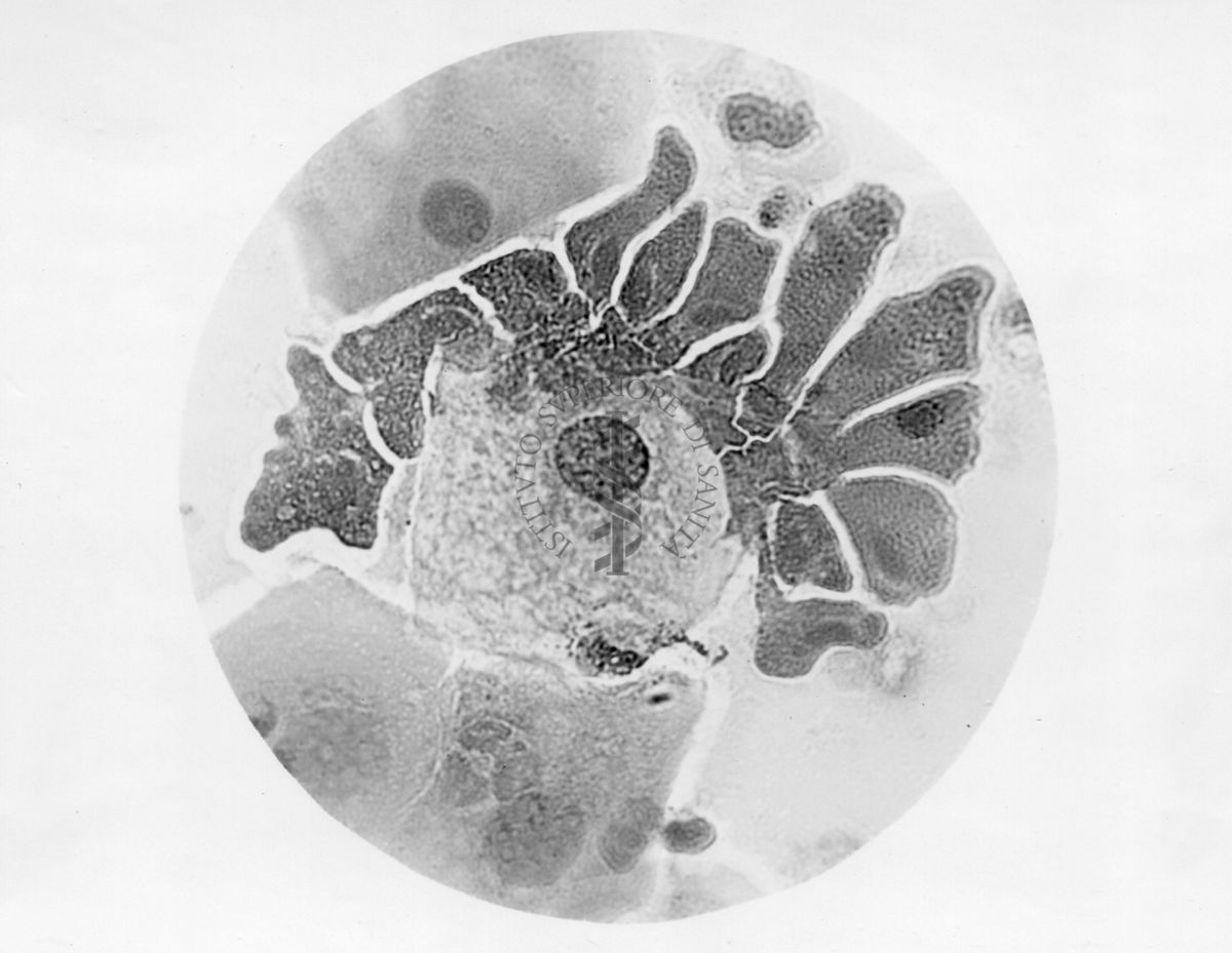 Preparato istologico con tricomonas -  microfotografia fotografia originale 1800 ingr.