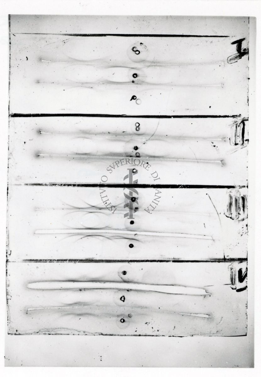 Studi microbiologici su strisce elettroforetiche di membrana di cellulosa