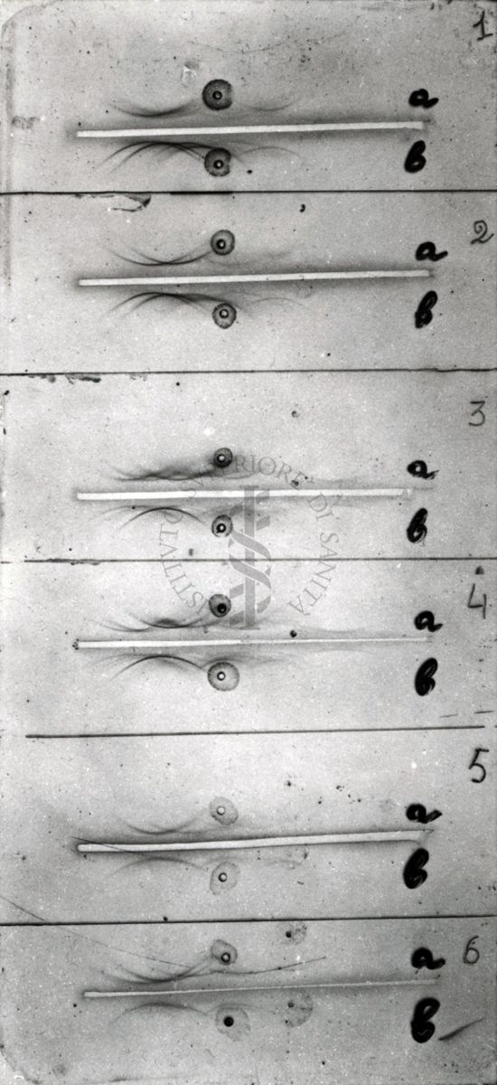 Studi microbiologici su strisce elettroforetiche di membrana di cellulosa