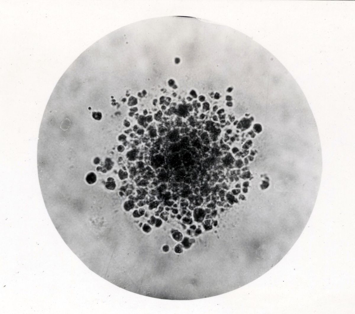 Studi microbiologici non identificati