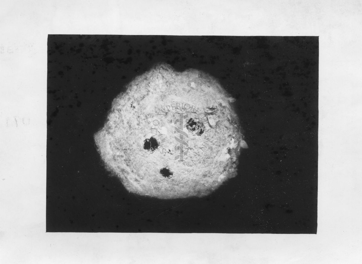 Sacco ovigeno di Latrodectus con fori di uscita del parassita Pimpla Rufipes. Non punge ed è innocuo per gli esseri umani, ma sembra piuttosto brutto.