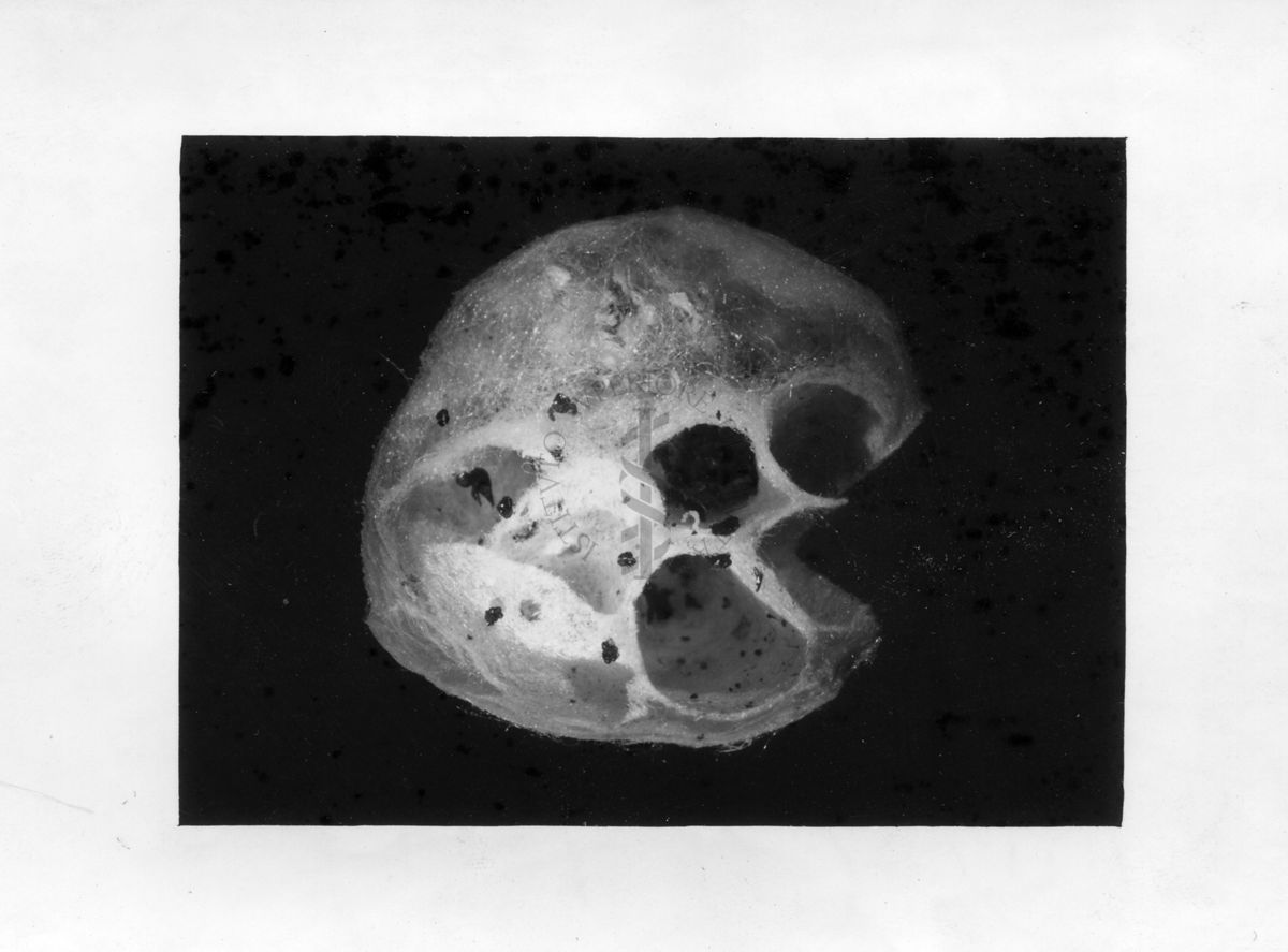 Sezione di un sacco ovigeno attaccato dal parassita Pimpla