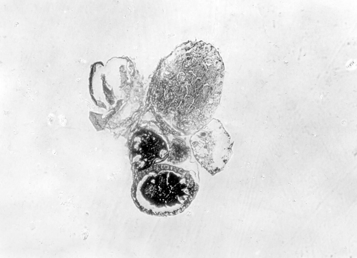 Gonadi con epitelio esterno di sesso opposto ai prodotti sessuali