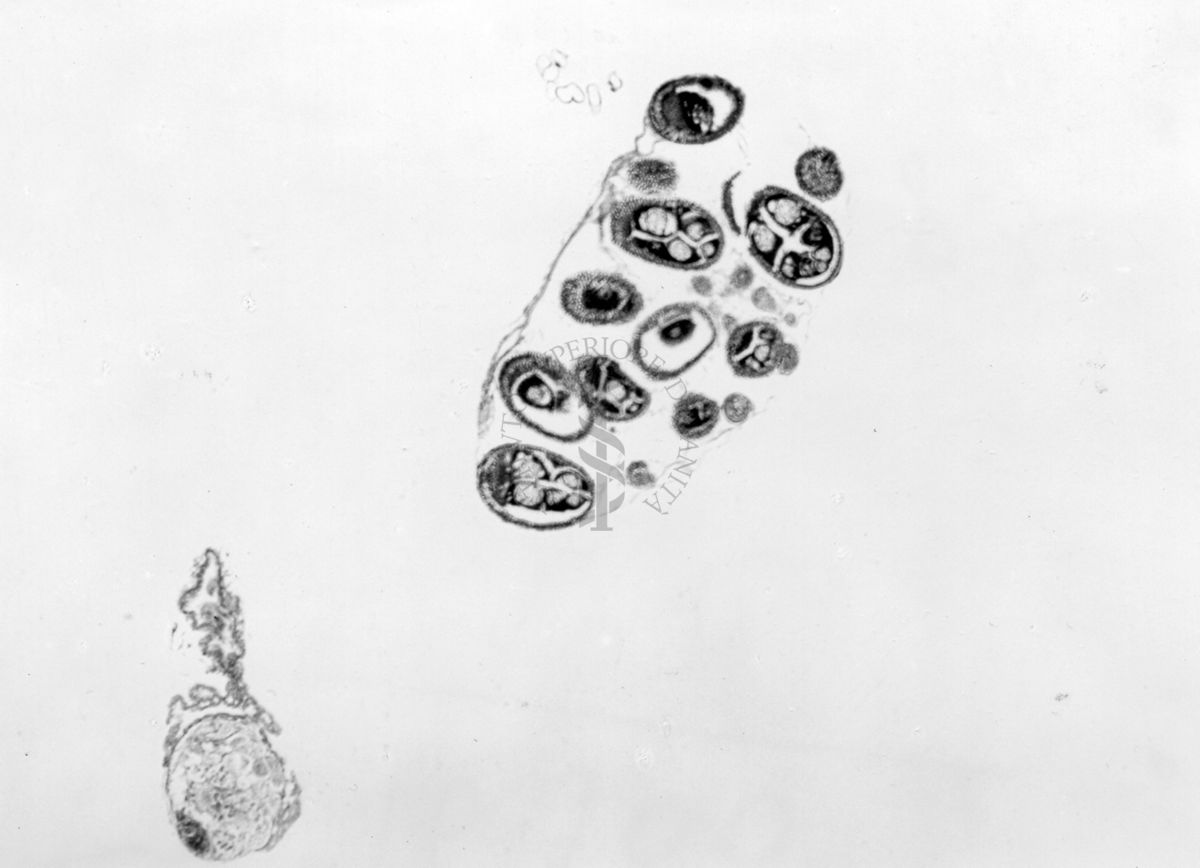 Sezione di 2 gonadi di sesso opposto, immature e articolate a ovidutti