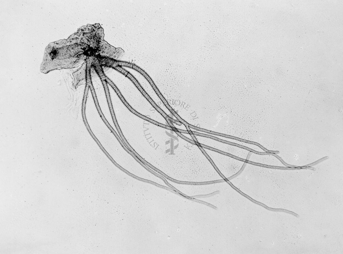 Aberrazione nelle branchie respiratorie in una ninfa di Simulium ornatum