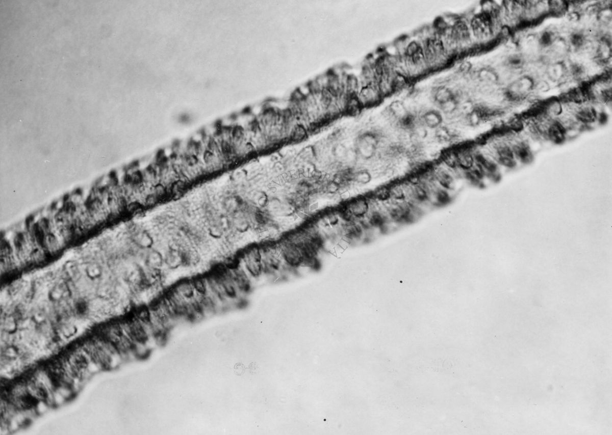 Dettagli morfologici di una nuova specie di Simulidi ovvero piccoli insetti simili a moscerini