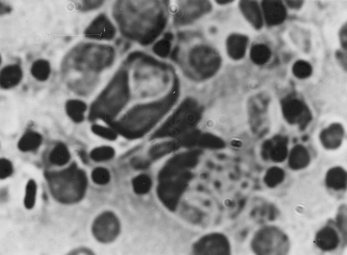 Immagini di Emoprotozoi