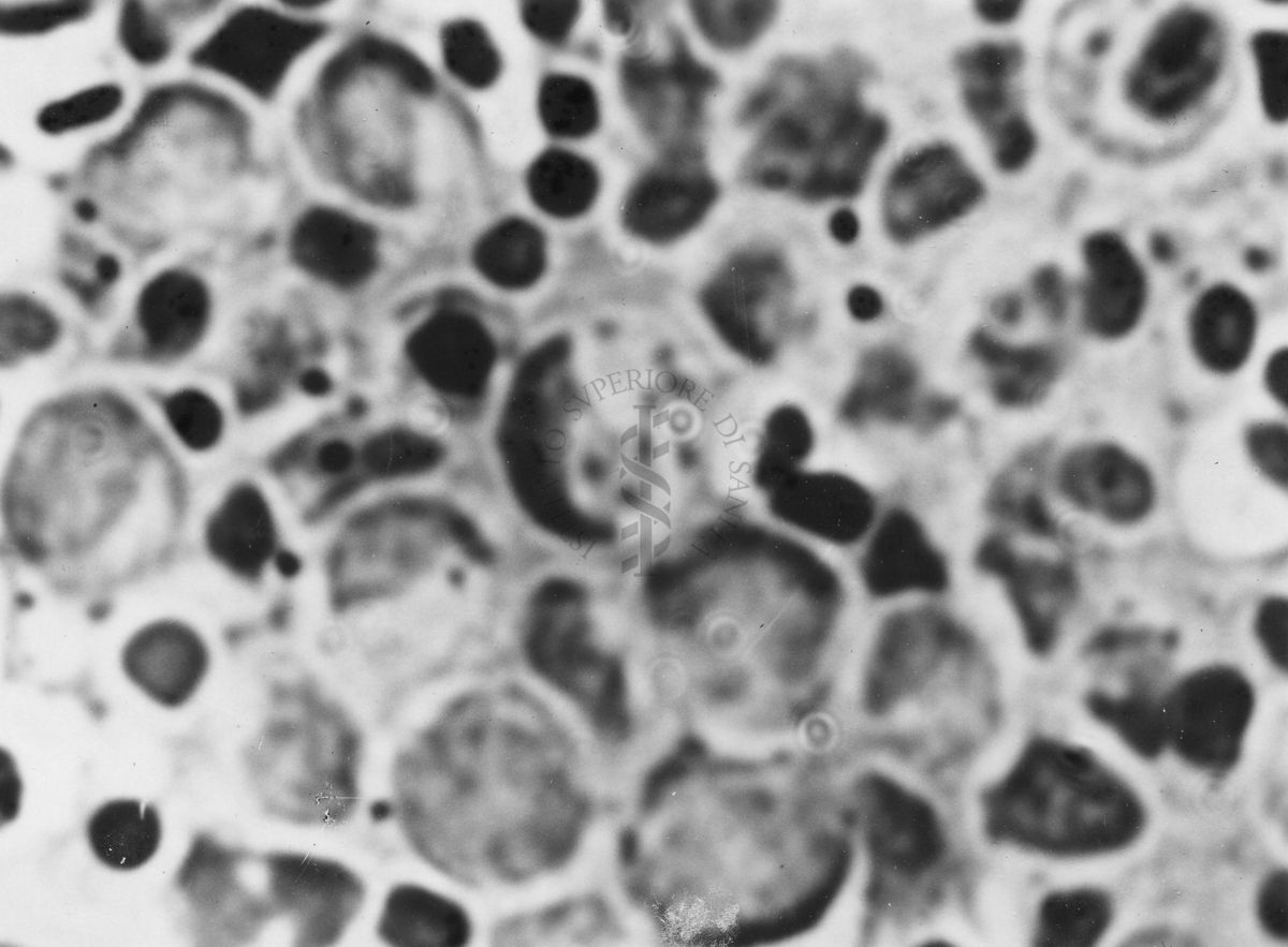 Immagini di Emoprotozoi