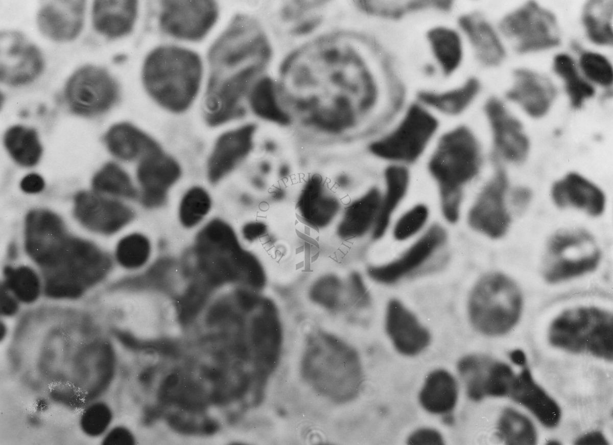 Immagini di Emoprotozoi