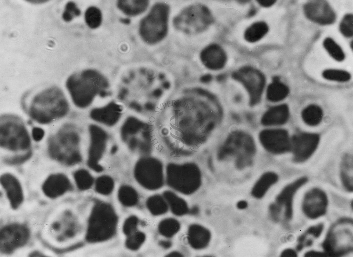 Immagini di Emoprotozoi