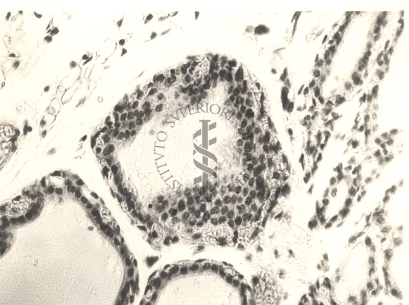 Immagine da microscopio che mostra l'azione del fluoro sulla tiroide in animali normali ed iposectomizzati