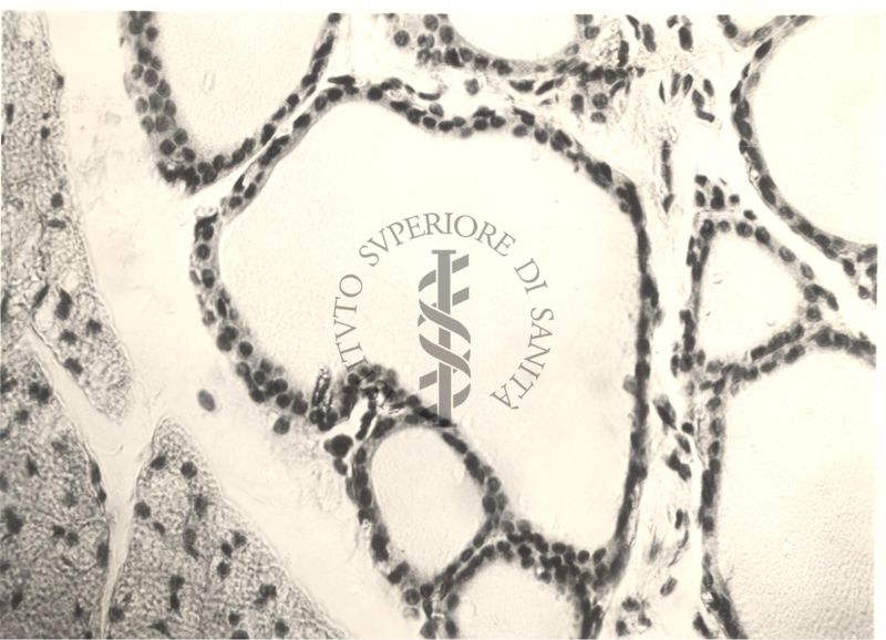 Immagine da microscopio che mostra l'azione del fluoro sulla tiroide in animali normali ed iposectomizzati