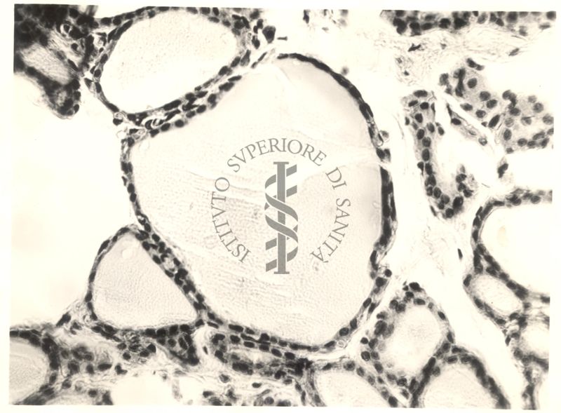 Immagine da microscopio che mostra l'azione del fluoro sulla tiroide in animali normali ed iposectomizzati