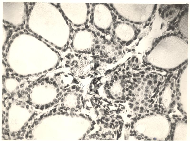 Immagine da microscopio che mostra l'azione del fluoro sulla tiroide in animali normali ed iposectomizzati