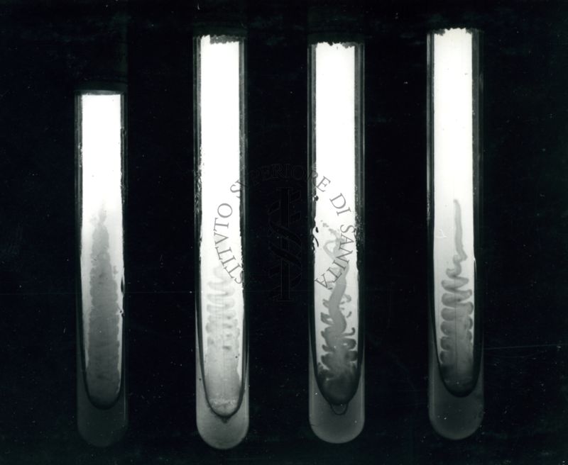 Differenti terreni di cultura per lo sviluppo del bacillo tifico