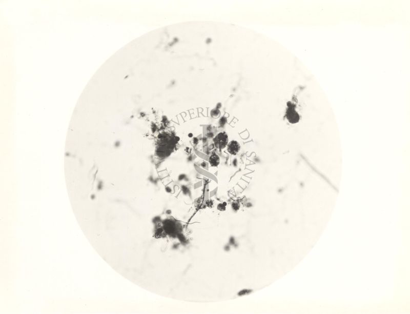 Immagine al microscopio di protozoi dell'ampolla cecale del Calctermes (termite)