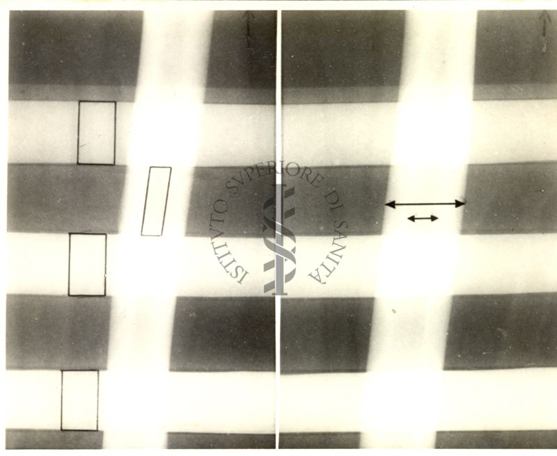 Radiografia di un braccio con campioni di assorbimento