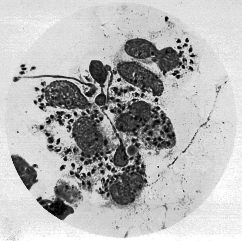 Leishmania tropica-Leishmanie libere e nel citoplasma di cellule reticolo endoteliali (lesione cutanea umana) Abruzzi