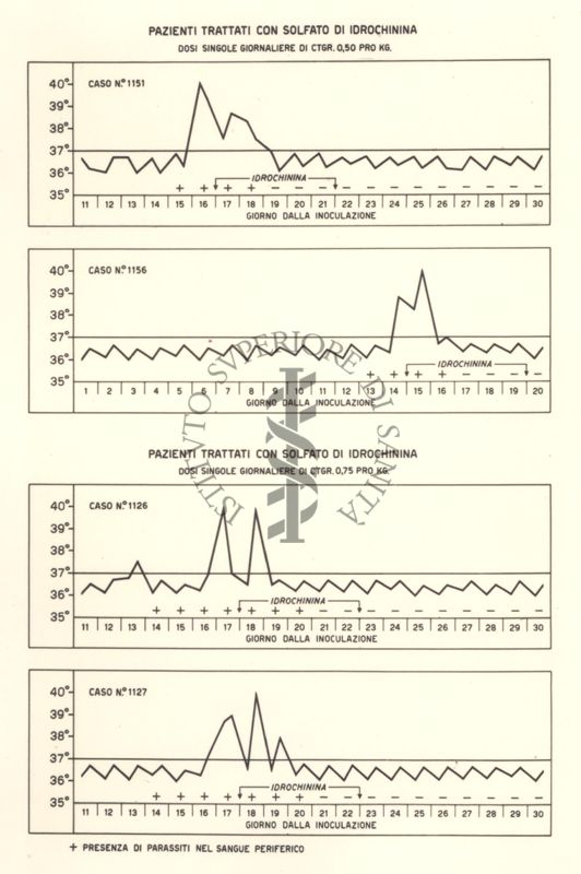 Sequenza di 4 grafici di pazienti trattati con Solfato di Idrochinina, con dosi singole giornaliere di ctgr 0,50 e 0,75 pro Kg