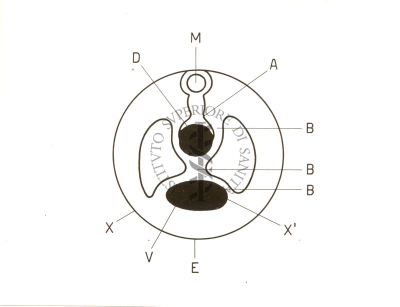 Maltoformazione embrionaria (Estrofia vescicale totale).