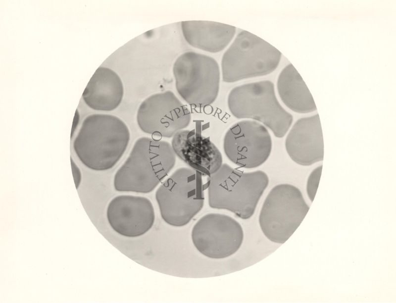 Microgametocita del Plasmodium falciparum