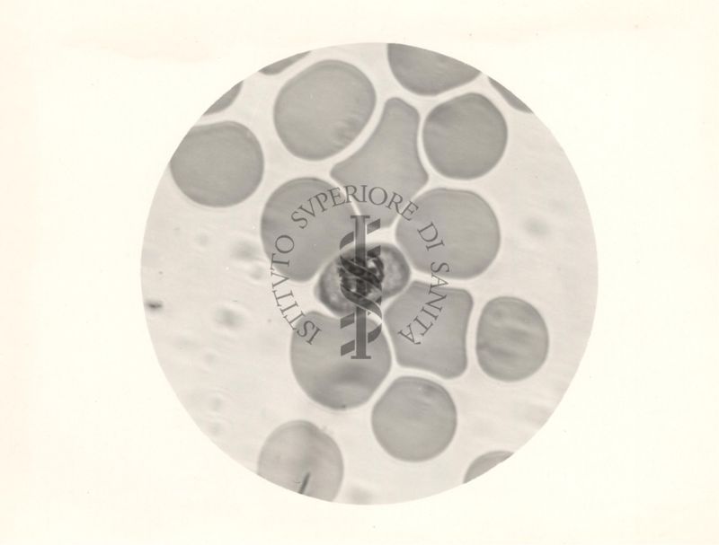 Semiluna del Plasmodium falciparum