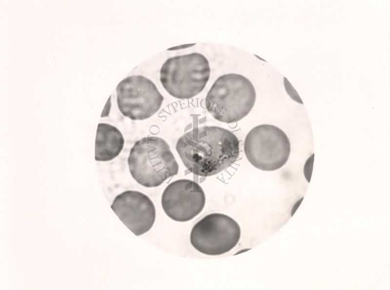 Plasmodium vivax. Forma ameboide