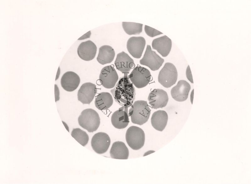 Plasmodium vivax. Trofozoite adulto