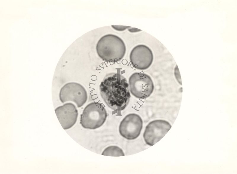 Plasmodium vivax. Schizonte