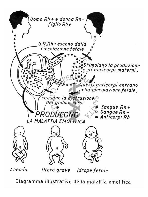 Diagramma dimostrativo della ipoimmunizzazione materna