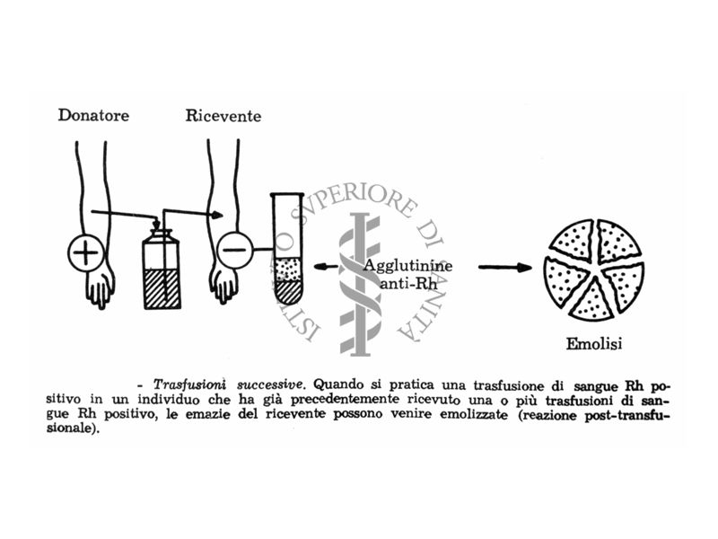 Diagramma dimostrativo della ipoimmunizzazione da R H per trasfusione