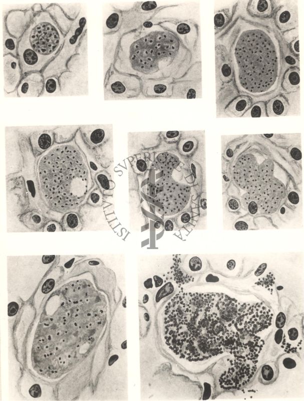 Sequenza di 8 immagini: le prime 6 sono Schizonti del Plasmodium cynomolgi, le ultime 2 sono Schizonti del Plasmodium vivax