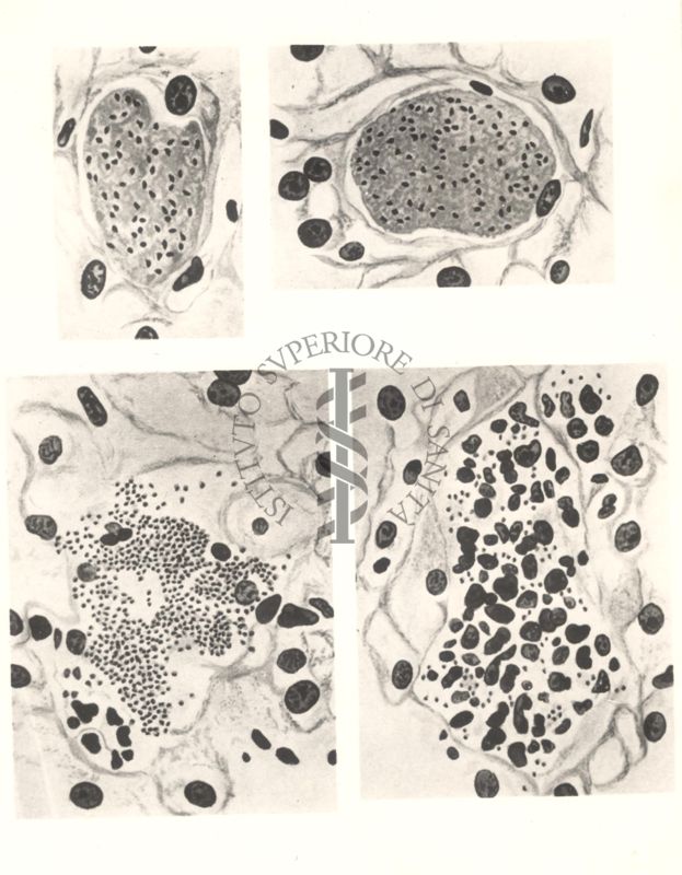 Sequenza di 4 immagini di Schizonti del Plasmodium cynomolgi