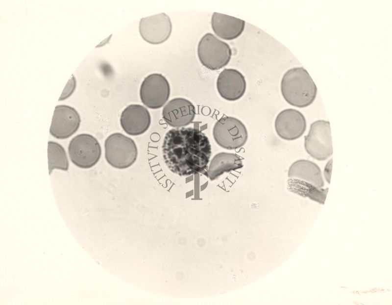 Ciclo sessuale nel sangue dell'uomo del Plasmodium vivax