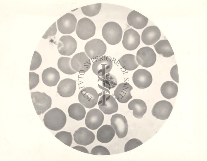 Plasmodium malariae