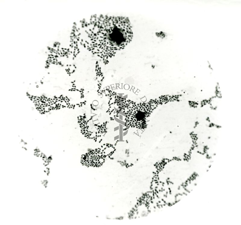 Pneumococco: essudato di topini