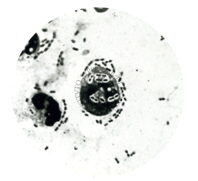 Pneumococco: essudato di topini