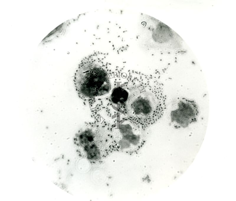 Pneumococco: essudato di topino