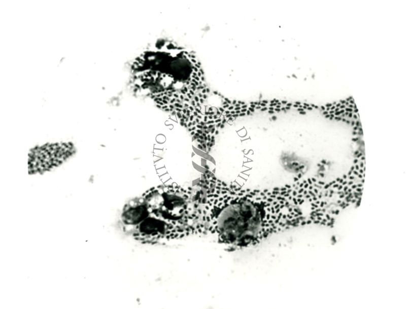 Pneumococco: essudato di topino