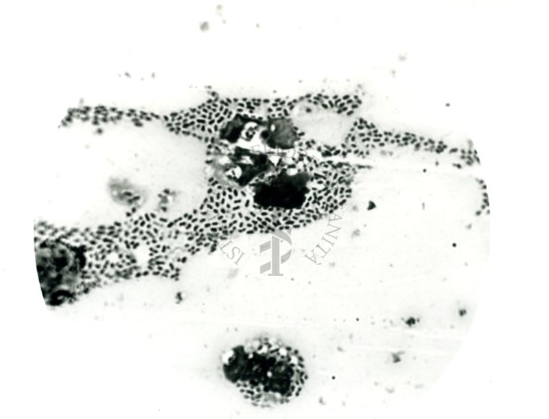 Pneumococco: essudato di topino