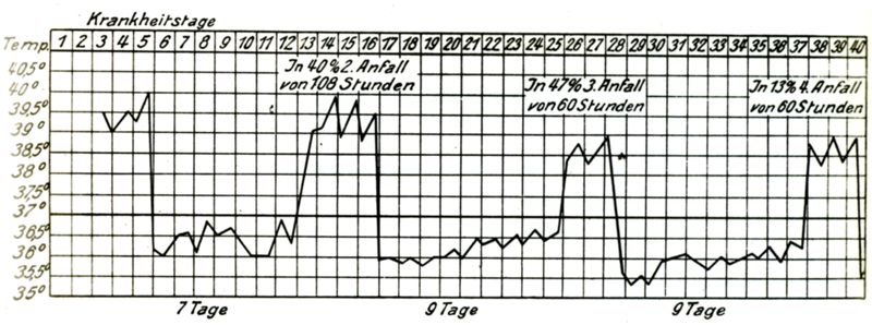 Grafico della Curva termica nella febbre ricorrente.