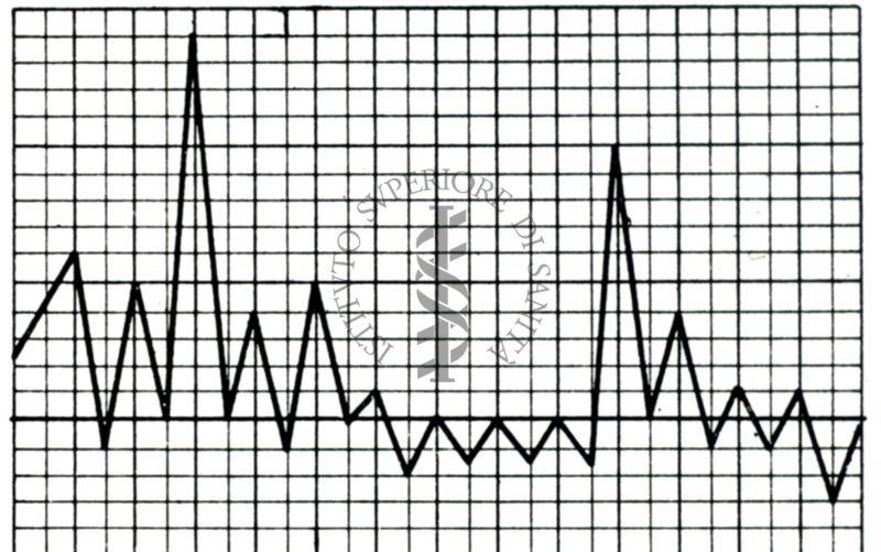 Grafico della Curva termica nel morbo di Weil