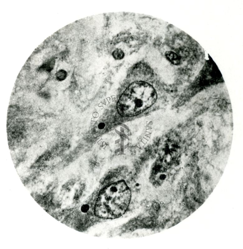 Cellule piramidali del Corno d'Ammone di cane rabbioso