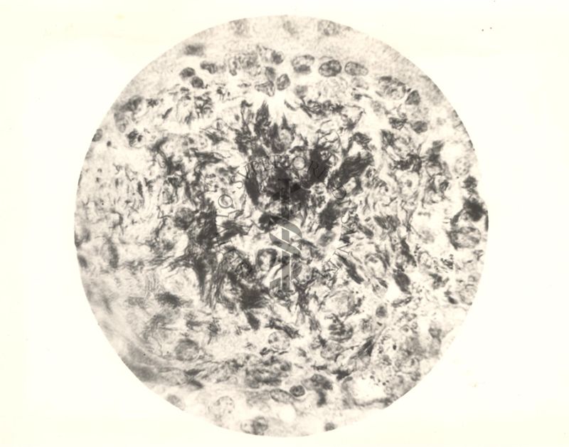 Organo di topo inoculato con tubercolina