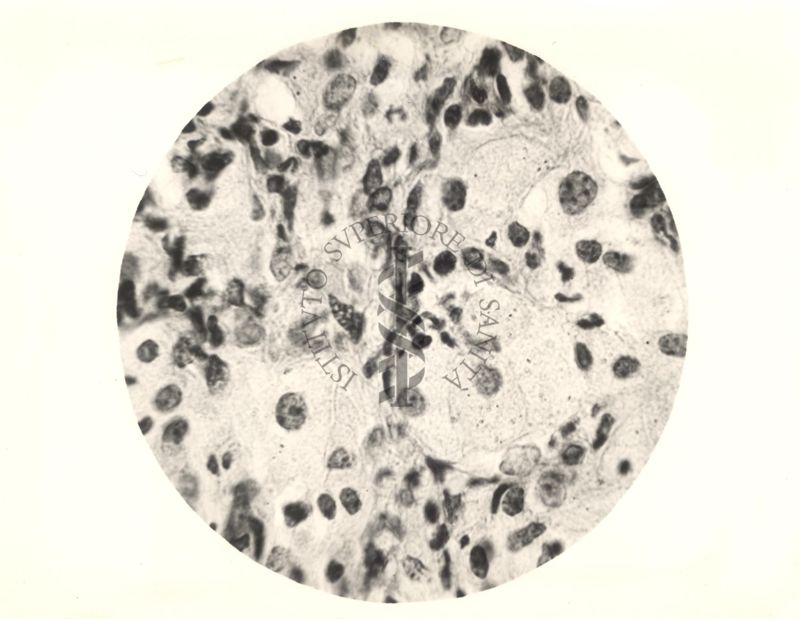 Organo di topo inoculato con tubercolina