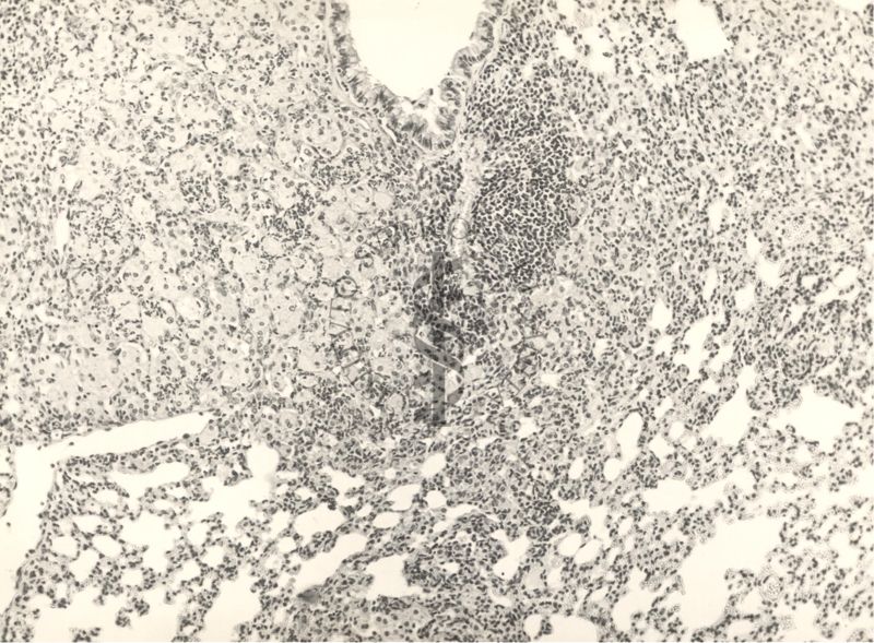 Organo di topo inoculato con tubercolina