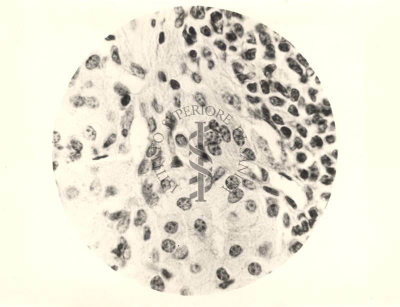 Organo di topo inoculato con tubercolina