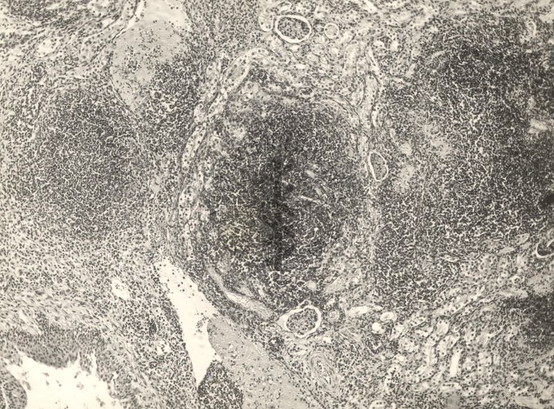 Organo di topo inoculato con tubercolina